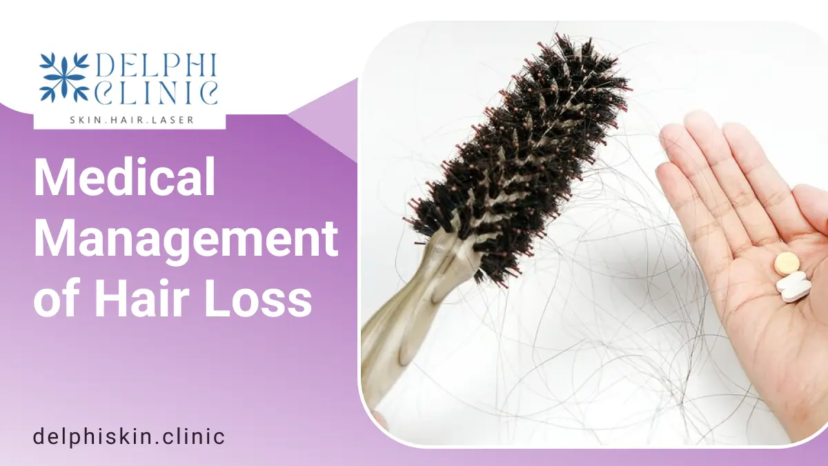Medical Management of Hair Loss | Delphi Skin Clinic