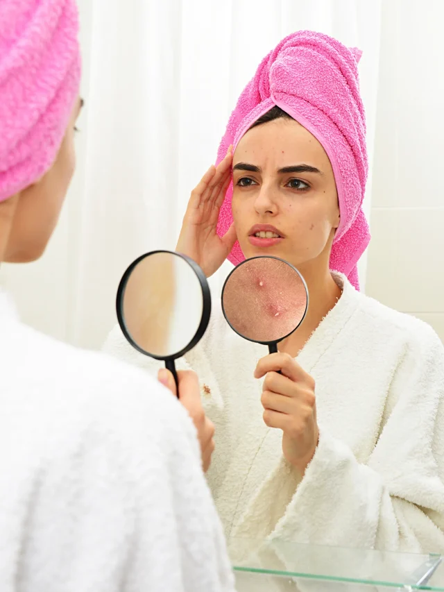 young-girl-with-problematic-skin-holding-magnifier-her-acne-while-looking-mirror