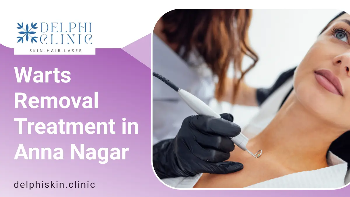 Warts Removal Treatment in Anna Nagar