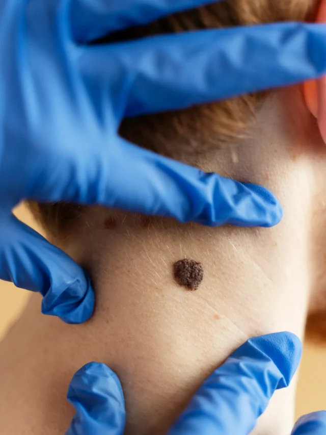 young-man-with-mole-neck-close-up