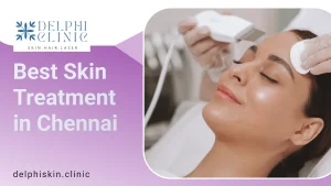 Best Skin Treatment in Chennai