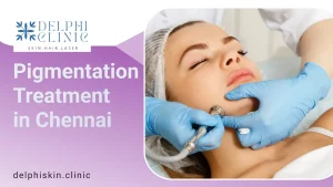 Pigmentation Treatment in Chennai