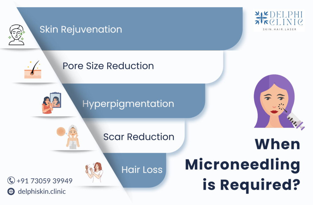 RF Microneedling in Anna Nagar